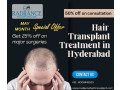 best-hair-transplant-treatment-in-hyderabad-natural-results-small-0