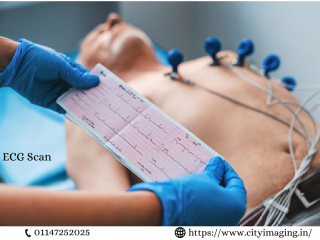 ECG Test Price What It Costs & What to Expect