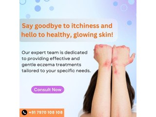 Best Skin specialist for eczema in Coimbatore
