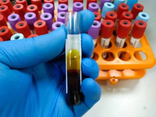 Top Lab Sample-Collecting Services Provider In Hyderabad