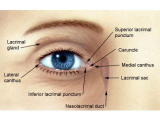 Cataract operation in Delhi