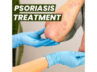 Effective Homeopathic Treatment for Scalp Psoriasis: A Path to Permanent Relief