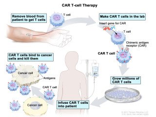Overview of CAR-T Cell Therapy for Cancer Treatment