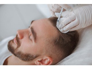 PRP Hair Treatment: A Non-Surgical Solution for Hair Regrowth