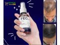 feg-plus-hair-growth-spray-price-in-jalalpur-jattan-small-0