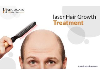 Laser Hair Growth Treatment Fresno,,