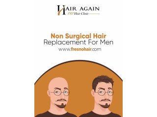 Non Surgical Hair Replacement For Men in Fresno, CA